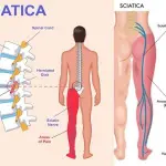 Joint, Back and Nerve Comfort Support Pack | Natural Supplements in Ghana