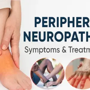 Nerve Damage and Peripheral Neuropathy Treatment Supplements