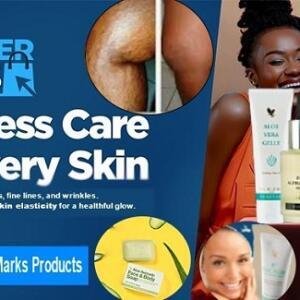 Stretch Marks Removal Creams and Essential Oils Without Surgery in Ghana