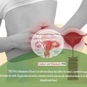 Pelvic Inflammatory Disease PID Treatment Medicine in Ghana