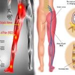 Nerve Comfort Support Pack | B Vitamin and Herbal Supplements in Ghana