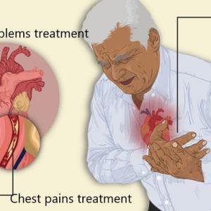 Cardiac Arrest Treatment Medicine in Ghana | Heart Emergency Recovery Support