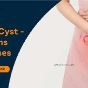 Ovarian Cyst Treatment Medicine in Ghana | Natural Ovarian Health Supplement