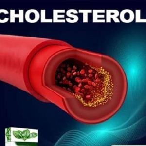 High Cholesterol Treatment Medicine in Ghana | Natural Cholesterol Lowering Supplement