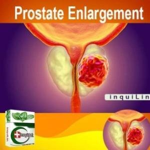 Prostate Enlargement BPH Treatment Medicine to Shrink Prostate Gland in Ghana