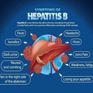 Hepatitis B Treatment Supplements and Herbal Medicines for Liver Care and Immune Boosting Ghana