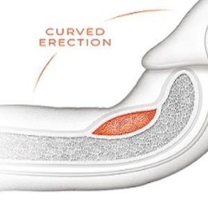 Curved Penis Penile Curvature Treatment Cream and Medicine in Ghana