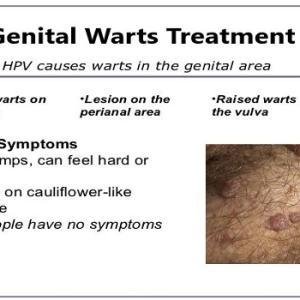 Genital Warts Treatment Medicine and Removal Cream in Ghana